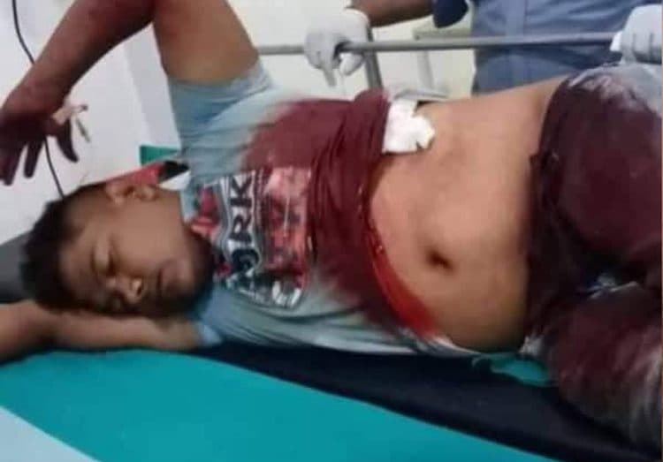 रुपन्देहीमा लुटपाट गरी गुरुङ माथि गोली प्रहार